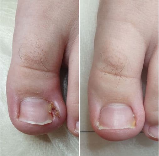 МОДЕЛИ  на  ПЕДИКЮР с ПРОБЛЕМАМИ